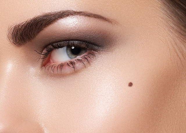 Mole Meaning – See What Birthmarks On Your Face & Body Tell About Your Future