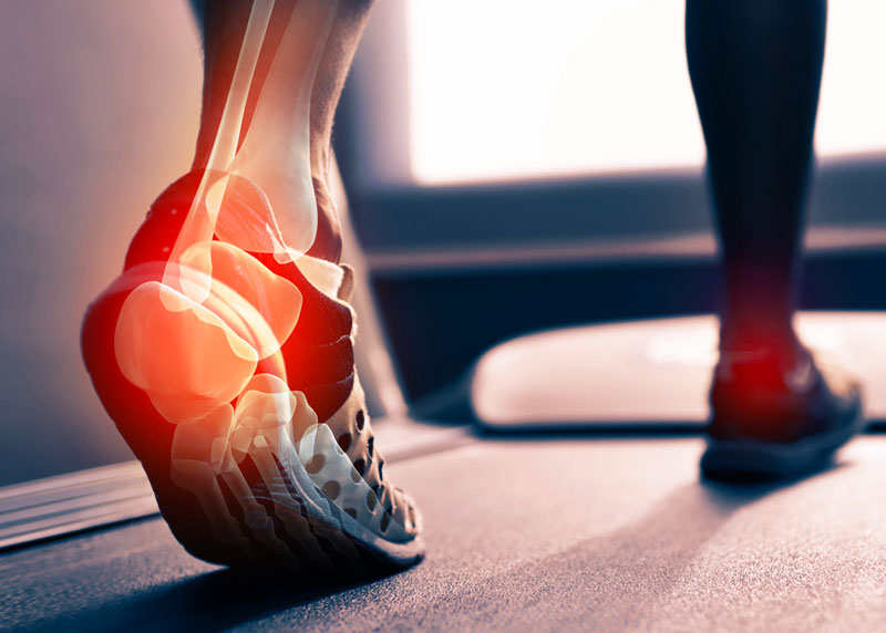 Yoga For Achilles Tendonitis – A Complete Guide